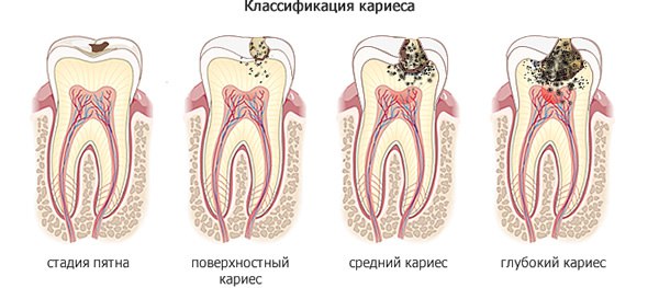 narodnye-metody-lecheniya-zubov-bolit
